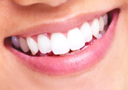 10-orthodontie-fonctionnelle appareils utilises blog Fin de traitement